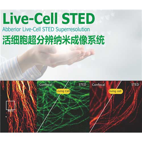 Abberior Live-Cell ϸֱϵͳ