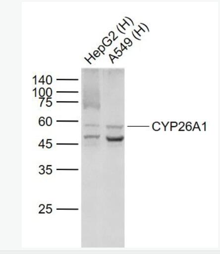 ϸɫcP450 CYP26A1õ¡