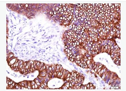 ΢ܵצ tubulin/Tubulin µ¡