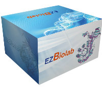 ӾԤƽ zymogram gel